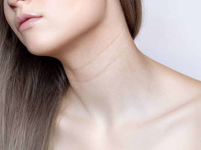 頸紋怎麼消除 640x480